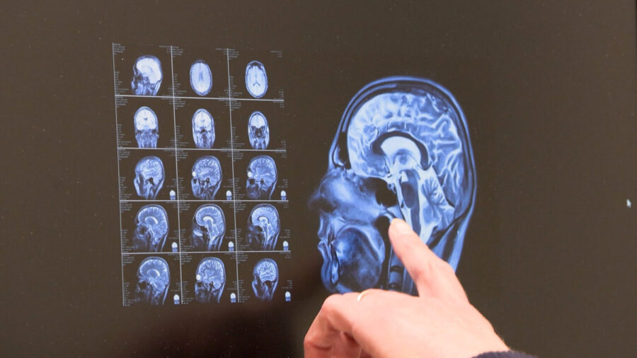 Utah couple shares journey navigating a terminal dementia diagnosis